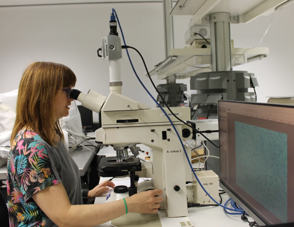 El IRBLleida y la UdL adquieren un nuevo microscopio
