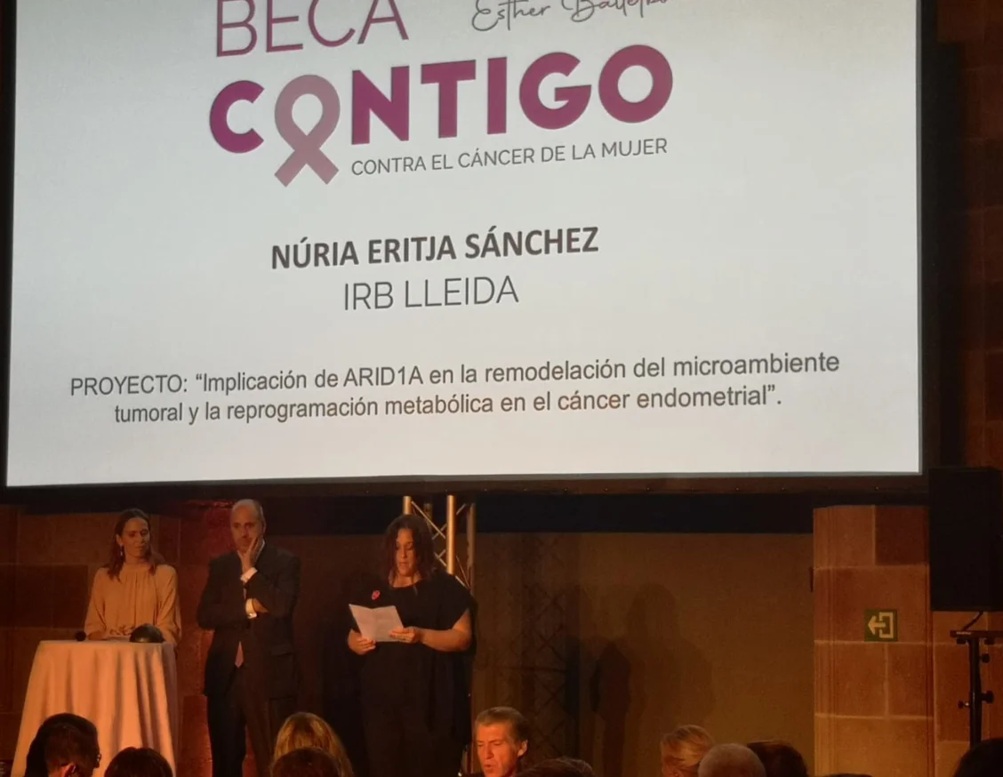 The Fundación Contigo against women's cancer grants a project in Lleida to identify new therapeutic options for uterine cancer