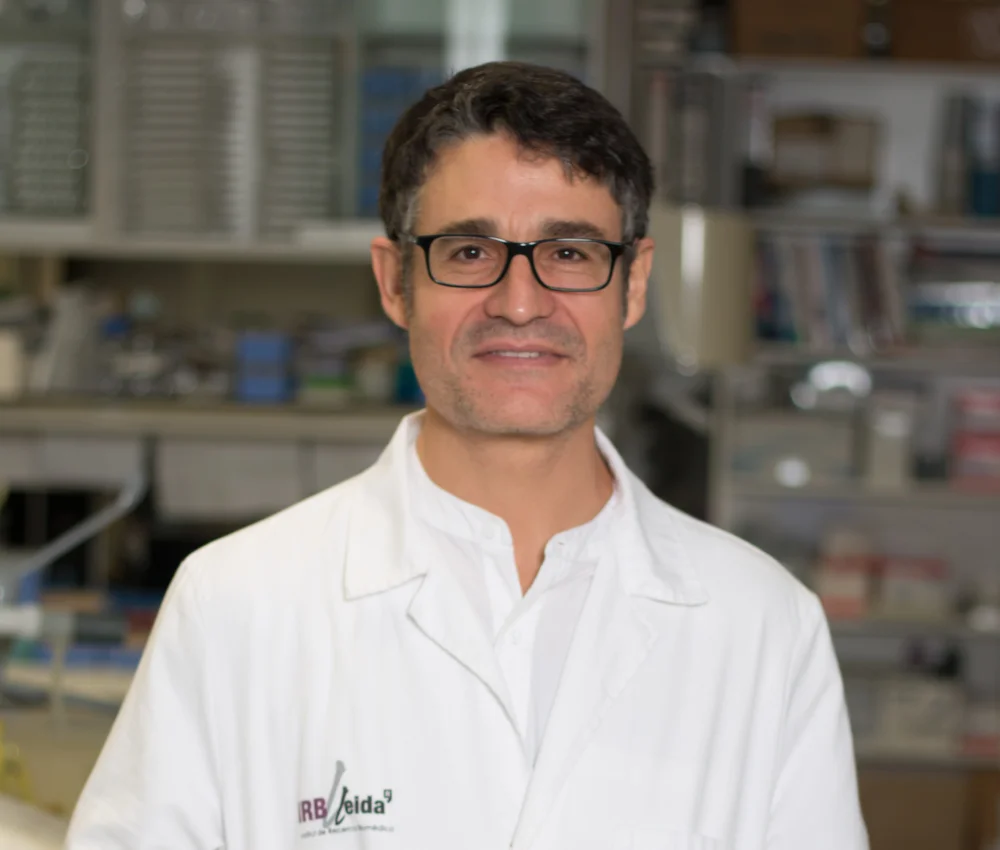 Identifiquen una proteïna com a element fonamental en el desenvolupament del cervell