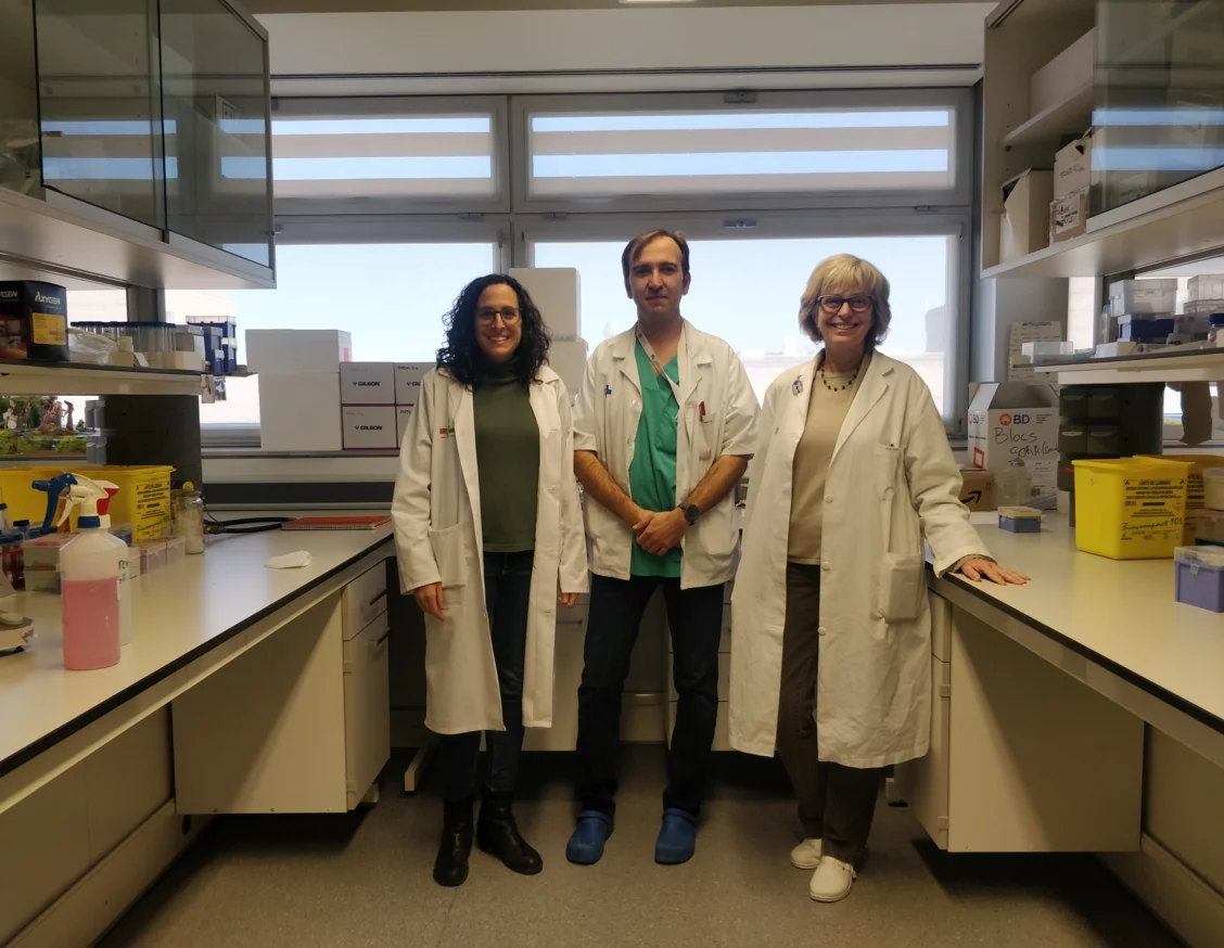 Research led from Lleida identifies a potential biomarker for the behaviour of melanomas