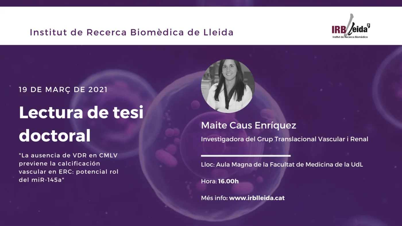 Lectura de tesis doctoral - Personal #IRBLleida